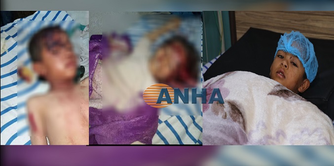 Heavy civilian casualties as result of Turkish airstrike in Manbij, northern syria